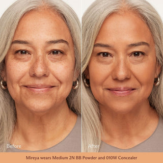 Medium 2N on skin