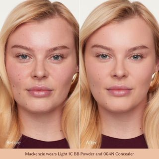 Light 1C on skin