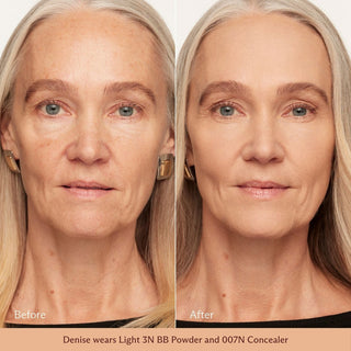 Light 3N on skin